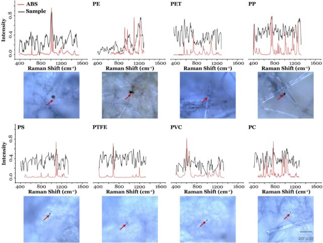 Microplastics in Semen