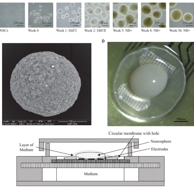 Images of clusters of brain cells grown in lab dishes, forming spherical masses called organoids. 