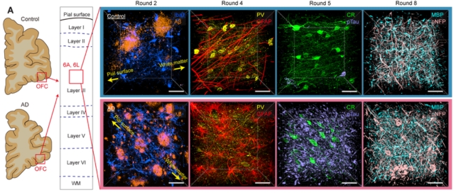 Images of brain tissue