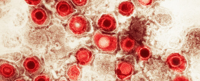 Electron microscope image of herpes virus, coloured red.