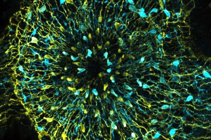 florescent microscopy of hydra nerve cells revealing two different populations of nerve cells